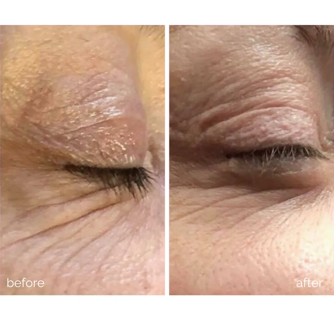MBK Eye Rejuvenator - Your Ultimate Solution for Ageless Eyes!